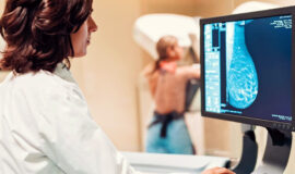 mamografia-monitor-1572447018622_v2_1920x1280